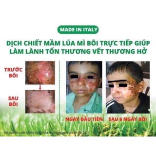 Gel Fitostimoline Proctogel (hàng chính hãng Ý)(làm lành vết thương hở...)