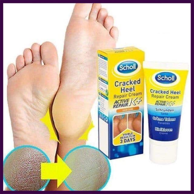 [Nhập Khẩu 100%] Kem Nứt Gót Chân SCHOLL SCHRUNDEN SALBE 25ml-60ml