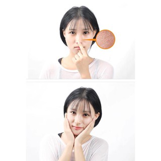 SERUM CHE KHÍT LỖ CHÂN LÔNG