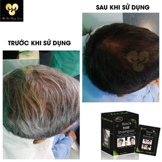 DẦU GỘI PHỦ BẠC(ĐEN TÓC) DEXE