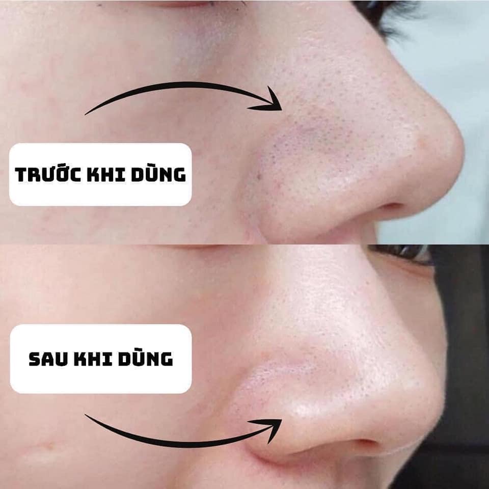 LOTION NƯỚC HOA HỒNG LABOLABO SE KHÍT CHÂN LÔNG - ALISA