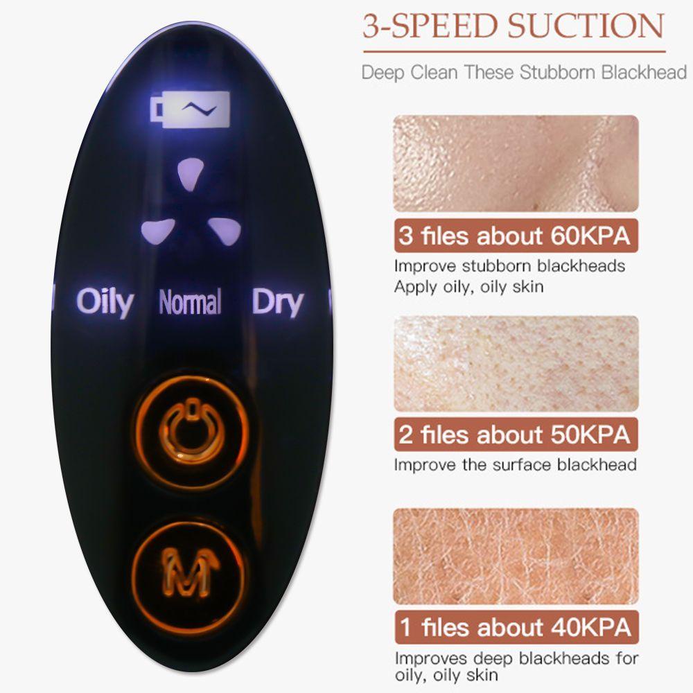 WATTLE Máy Hút Mụn Đầu Đen Làm Sạch Sâu Lỗ Chân Lông