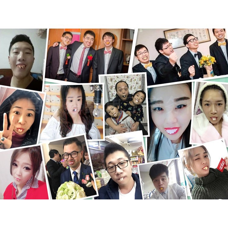 Răng giả dùng để hóa trang ngày cá tháng tư-Răng vẩu giả răng hô