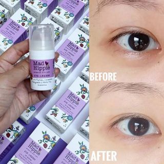 Kem mắt MAD HIPPIE EYE CREAM
