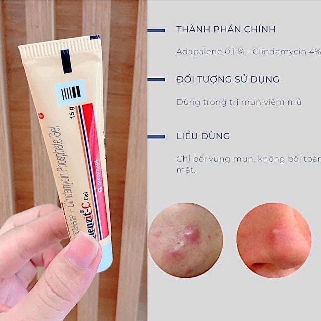 KEM GIẢM MỤN 15G