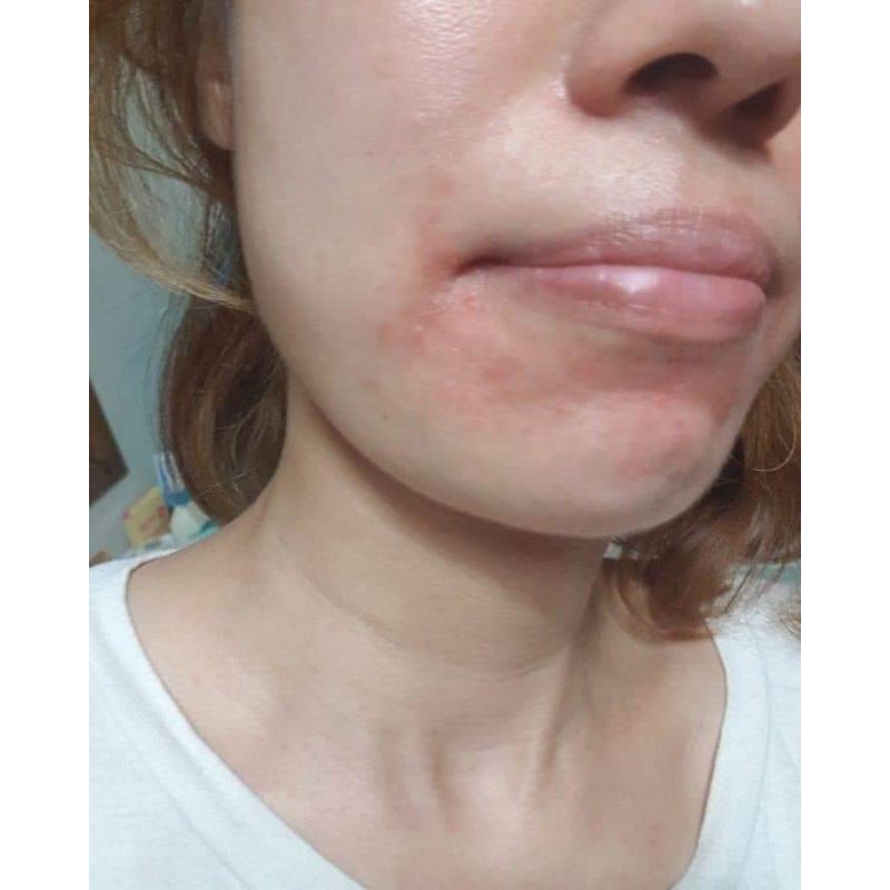 [Mã 153FMCGSALE giảm 8% đơn 500K] Toner Civasan Cấp nước phục hồi da mỏng yếu 100ml và 300ml | BigBuy360 - bigbuy360.vn