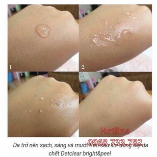 Tẩy da chết Detclear Nhật Bản 180ml