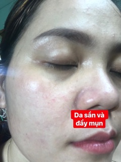 KEM TÁI TẠO CHAMOMILESKILL