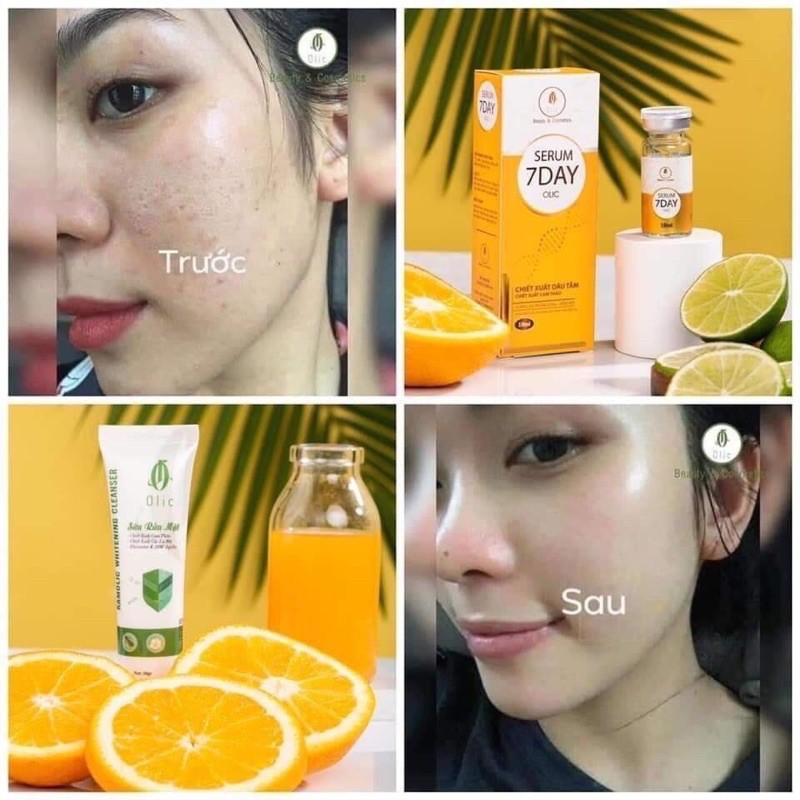 Serum huyết thanh truyền trắng 7 Day