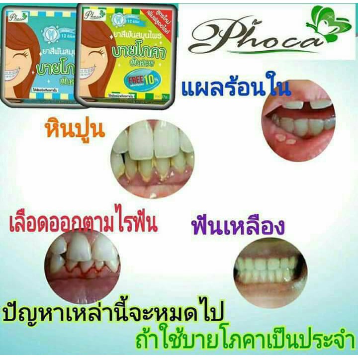 Kem đánh răng PhoCa xanh Dương Dành Cho Người Niềng Răng - 100% thiên nhiên, SX Thái Lan