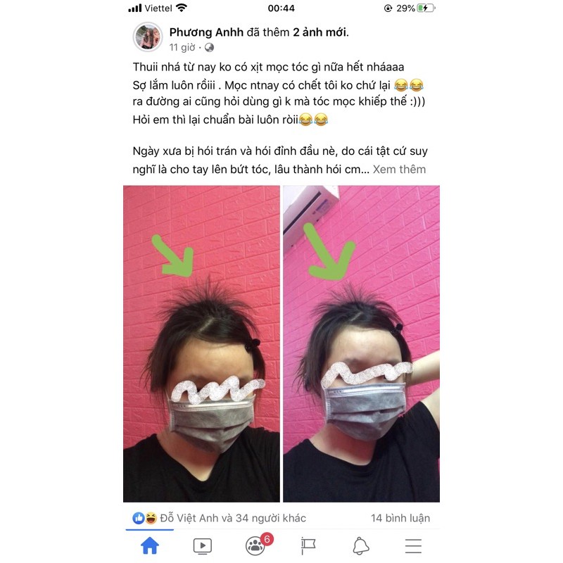 Xịt Tinh dầu bưởi non. Khắc tinh của hói, bò liếm, tóc mỏng | BigBuy360 - bigbuy360.vn