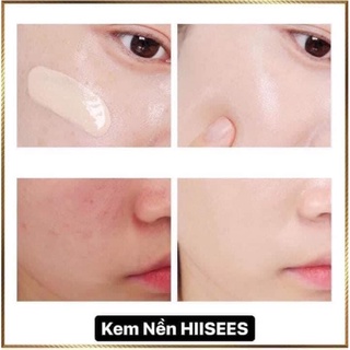 Kem nền che khuyết điểm