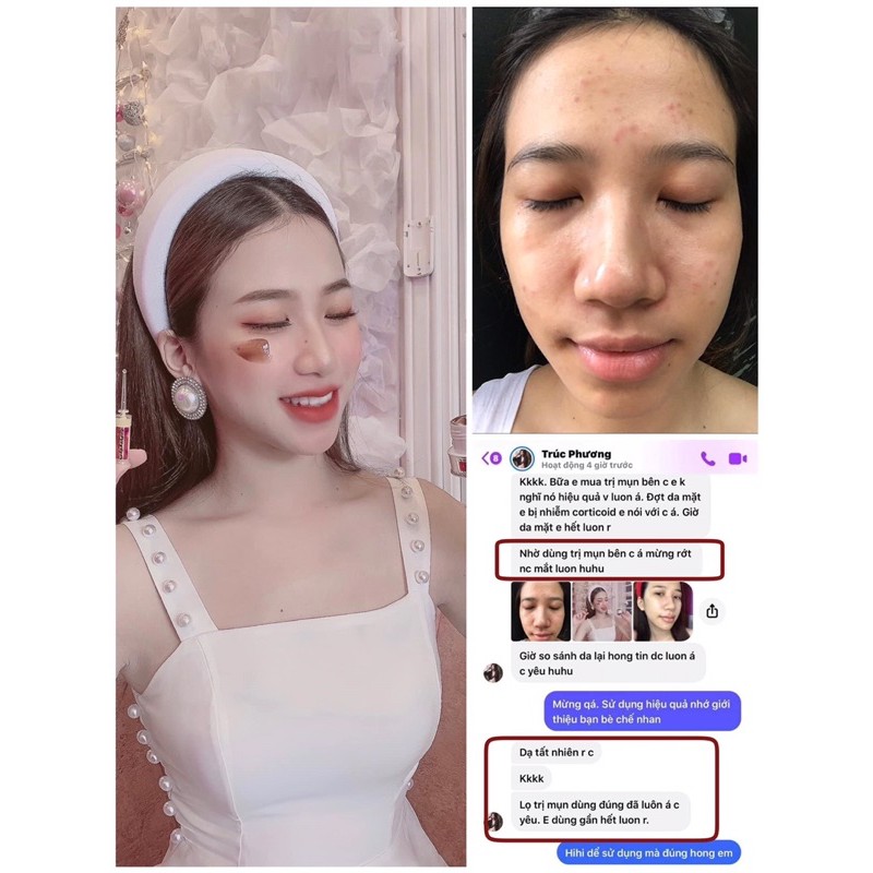 SỈ GIÁ ĐẸP NHẤT -  Cao mụn ĐÔNG TRÙNG HẠ THẢO  PEEL ONE