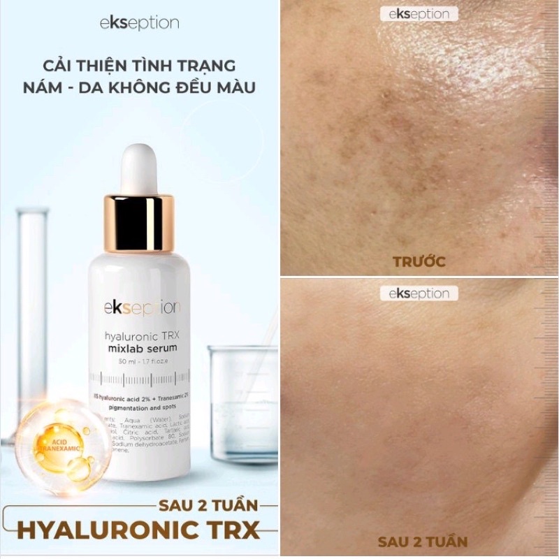 ✅ Chính hãng có tem ✅ Serum mờ thâm sáng da Ekseption Hyaluronic Niacin 50ml