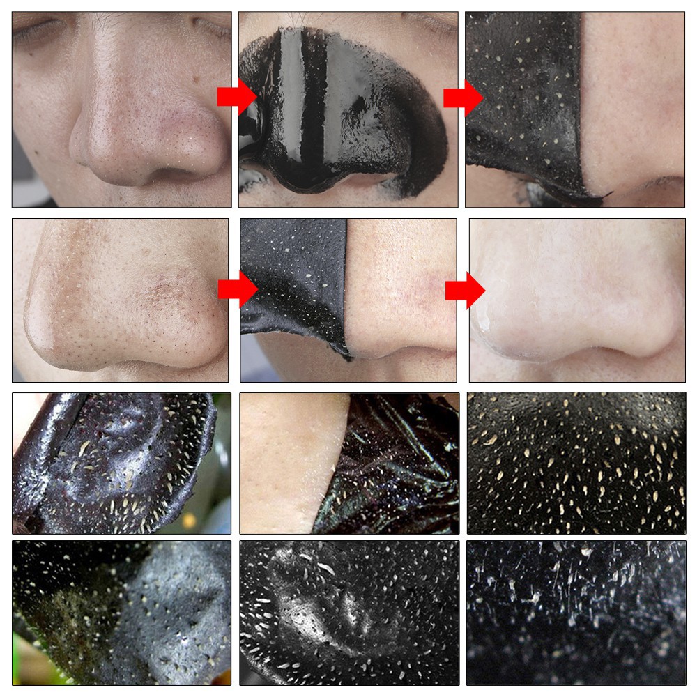 Bioqau Mặt Nạ Lột Mụn Đầu Đen Bioaqua Làm Sạch Sâu