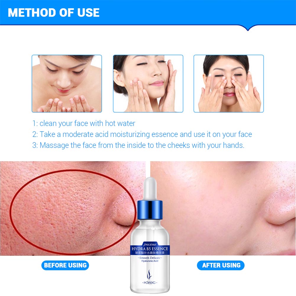 (Hàng Mới Về) Tinh Chất Axit Hyaluronic Giúp Nâng Cơ Mặt Và Chống Lão Hóa Hiệu Quả | BigBuy360 - bigbuy360.vn