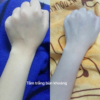 Tắm trắng bùn khoáng