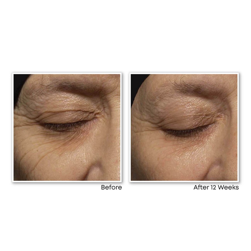 Kem xoá nhăn chuyên sâu RoC Retinol Correxion Deep Wrinkle Night Cream