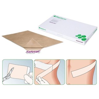01 MIẾNG DÁN  SẸ O Mepiform 4x30 cm(MOLNLYCKE – THỤY ĐIỂN)