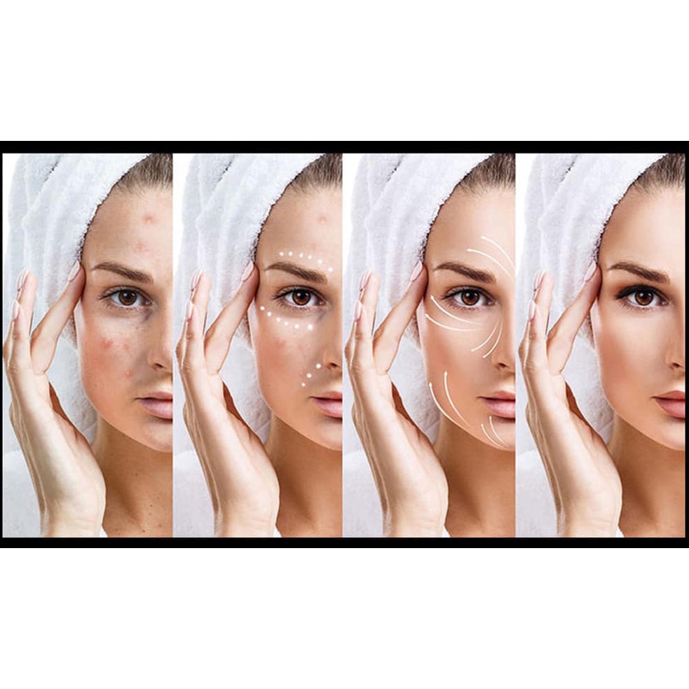 Kem Dưỡng Trắng Da Melasma-X Glutathione Brightening Tone Up 40ml - Hàn Quốc Cao Cấp Giá Gốc