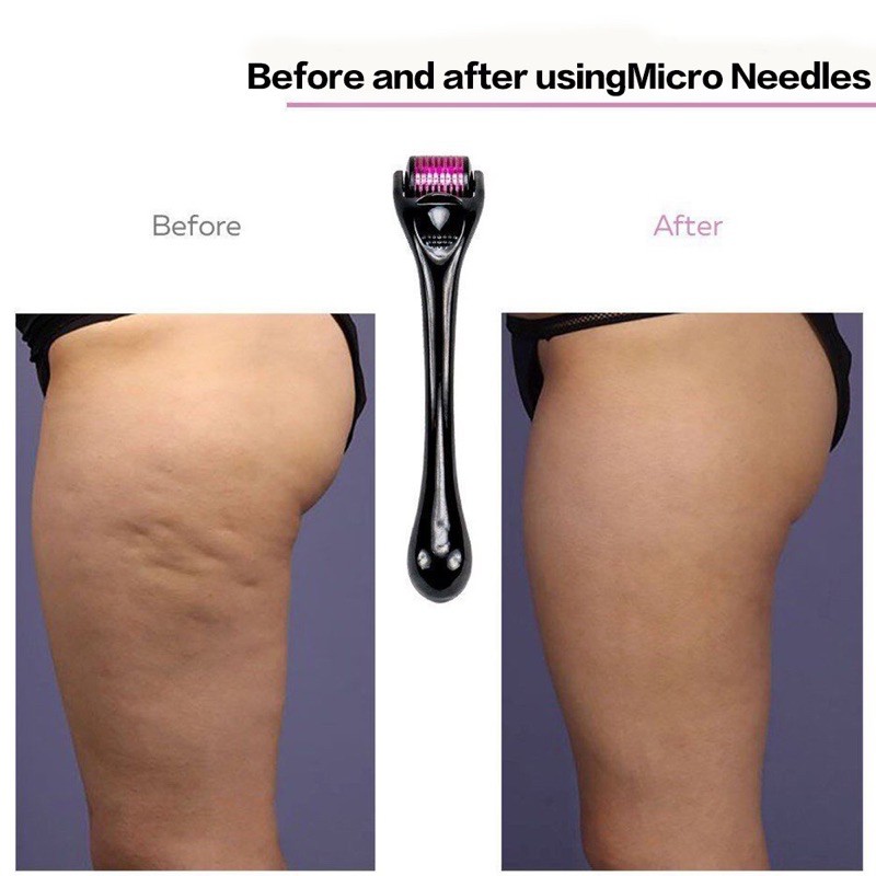 Precision Beauty - Thanh lăn kim Anti-Aging Micro-needle Derma Roller 0.25mm