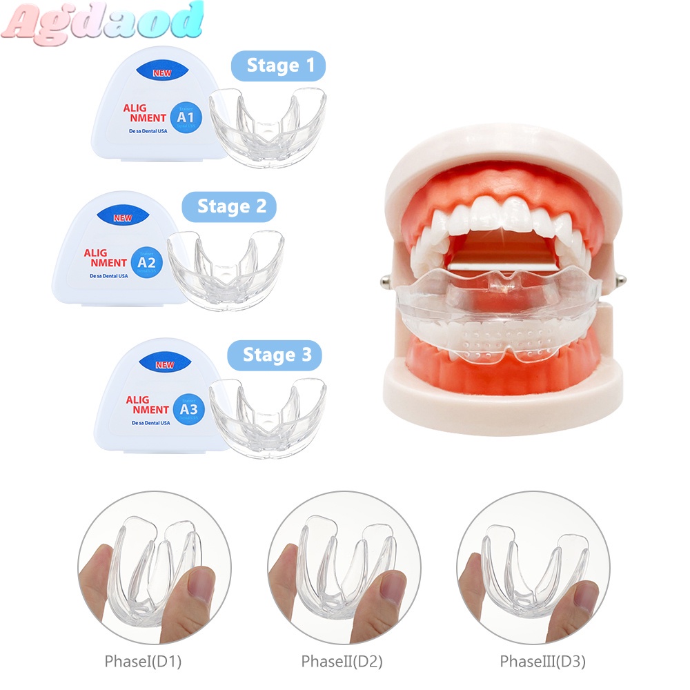 Set 3 Vòng Niềng Răng Vô Hình Chăm Sóc Răng Miệng ,Niềng răng trong suốt niềng răng tại nhà chính hãng ,Bộ niềng răng tại nhà, Bộ chỉnh nha dành cho người lớn và trẻ em A1 + A2 + A3 Trong Suốt Giúp Chỉnh Răng Ngay Tại nhà
