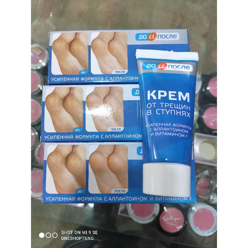 Kem trị nứt nẻ gót chân KPEM (Tuýp)