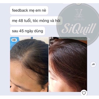 Tinh dầu bưởi non