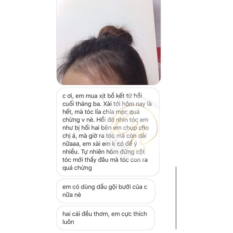 Xịt Tinh Chất Kích Mọc Tóc Giảm Rụng Trị Hói- KN Beauty Room | BigBuy360 - bigbuy360.vn