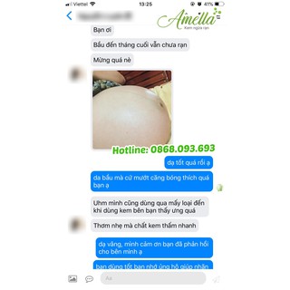 Kem ngừa rạn da Amella