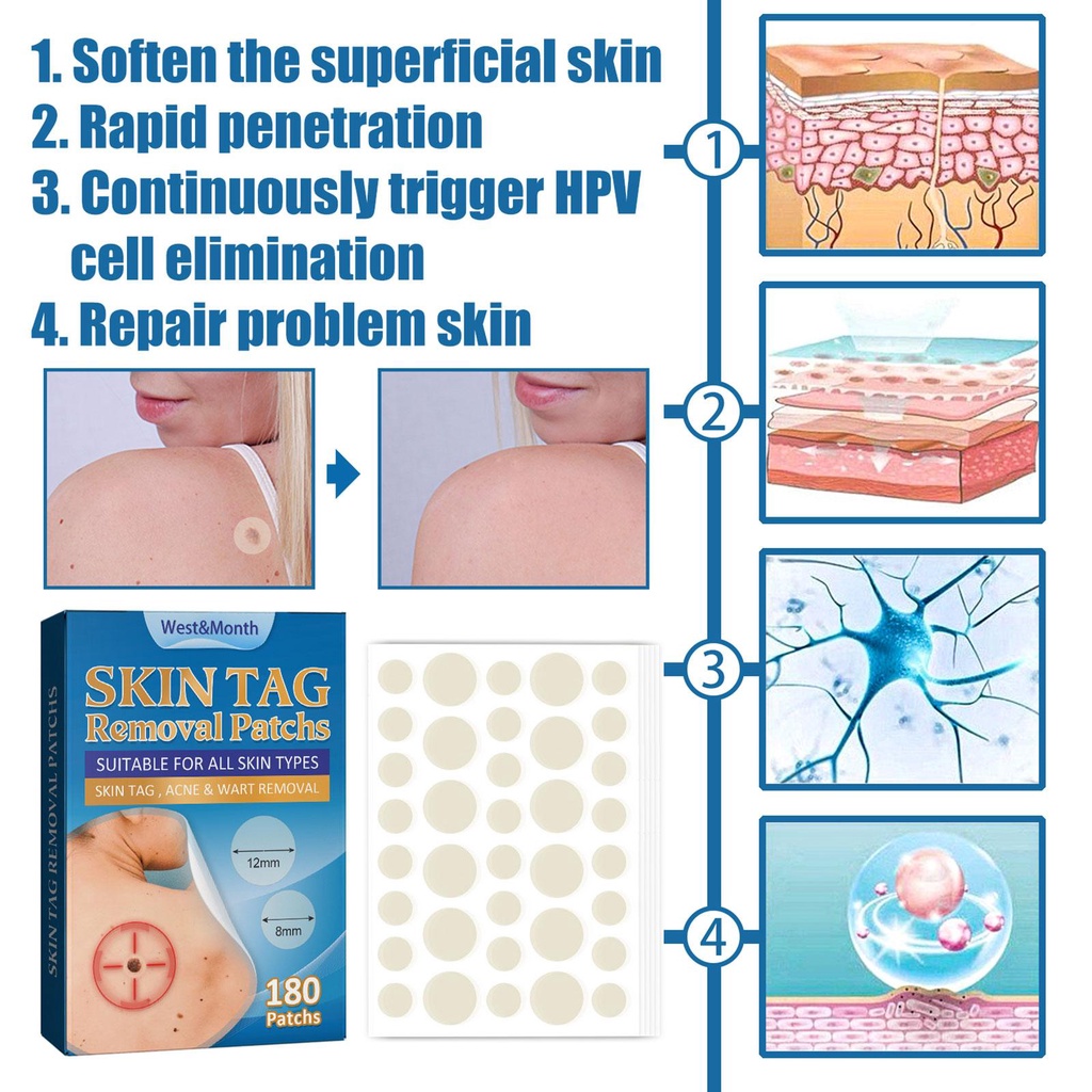 Hộp 180 Miếng Dán Hỗ Trợ Giảm Mụn Tinh Chất Hydrocolloid / Mụn Trứng Cá / Mụn Nhọt Vô Hình