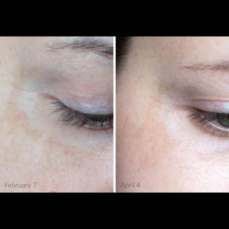 Tinh chất Serum SkinCeuticals C E Ferulic Minisize 4ml CEF