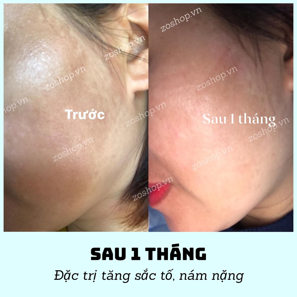 Kem dưỡng trắng, giảm nám/ tàn nhang, chống lão hóa - Transino Whitening Repair Cream EX (35g)