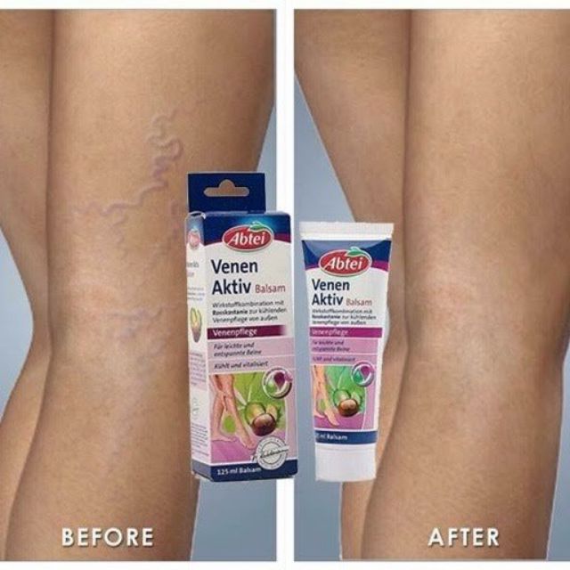 Kem Bôi Trị Giãn Tĩnh Mạch chân Venen Aktiv Creme Balsam Abtei Germany