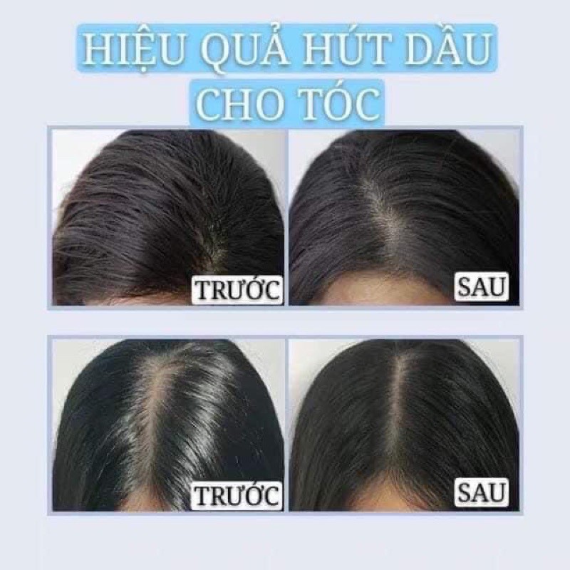 Dầu gội đầu khô