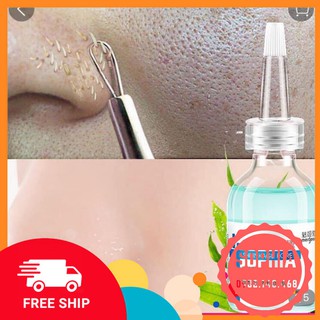 Serum che khít lỗ chân lông