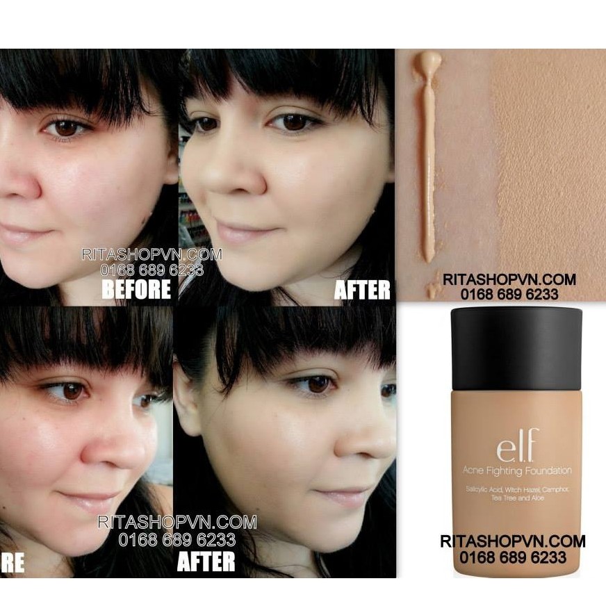 [BILL MỸ] Kem nền Elf che phủ và loại bỏ mụn - Elf Acne Fighting foundation