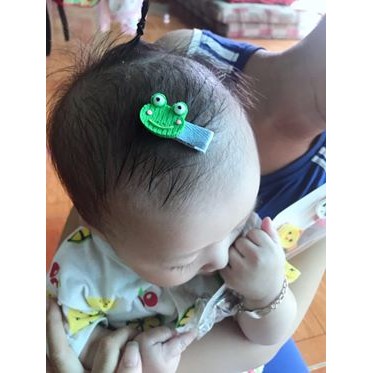 Set 5 kẹp tóc nhựa siêu xinh cho bé hàng cao cấp MiMi Shop