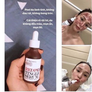 Red peel tingle serum