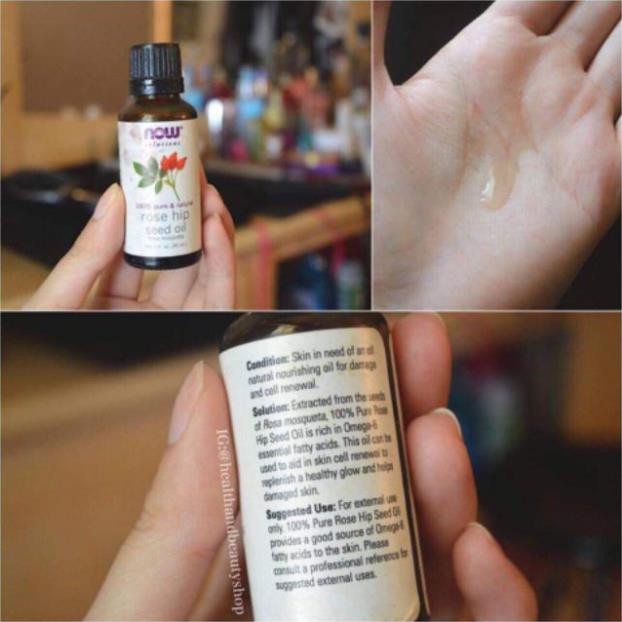[Nhập Mỹ] Dầu nụ tầm xuân Now Rosehip Seed Oil 30ml