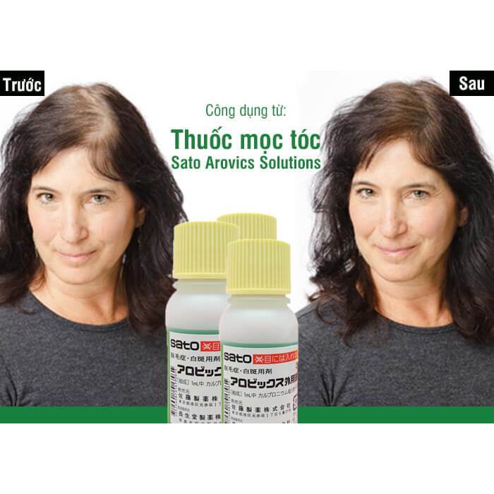 Bôi Kích Thích Mọc Tóc Thảo Dược Sato Nhật Bản 30ml