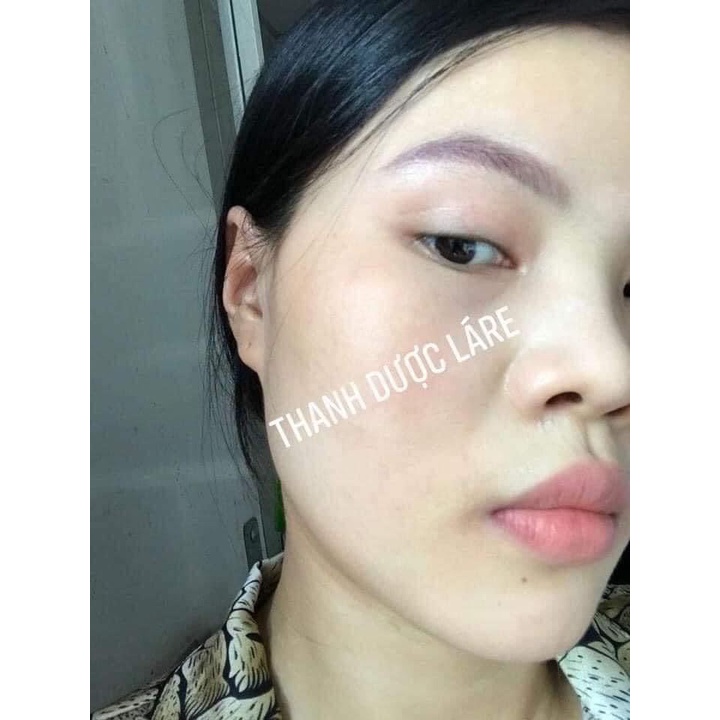 BỘ ĐÔI THẦN THÁNH CHO LÀN DA KHÔNG NÁM KHÔNG TÀN NHANG HERBAL SERUM VER.2 VÀ SỮA RỬA MẶT LÁRE THANH DƯỢC.