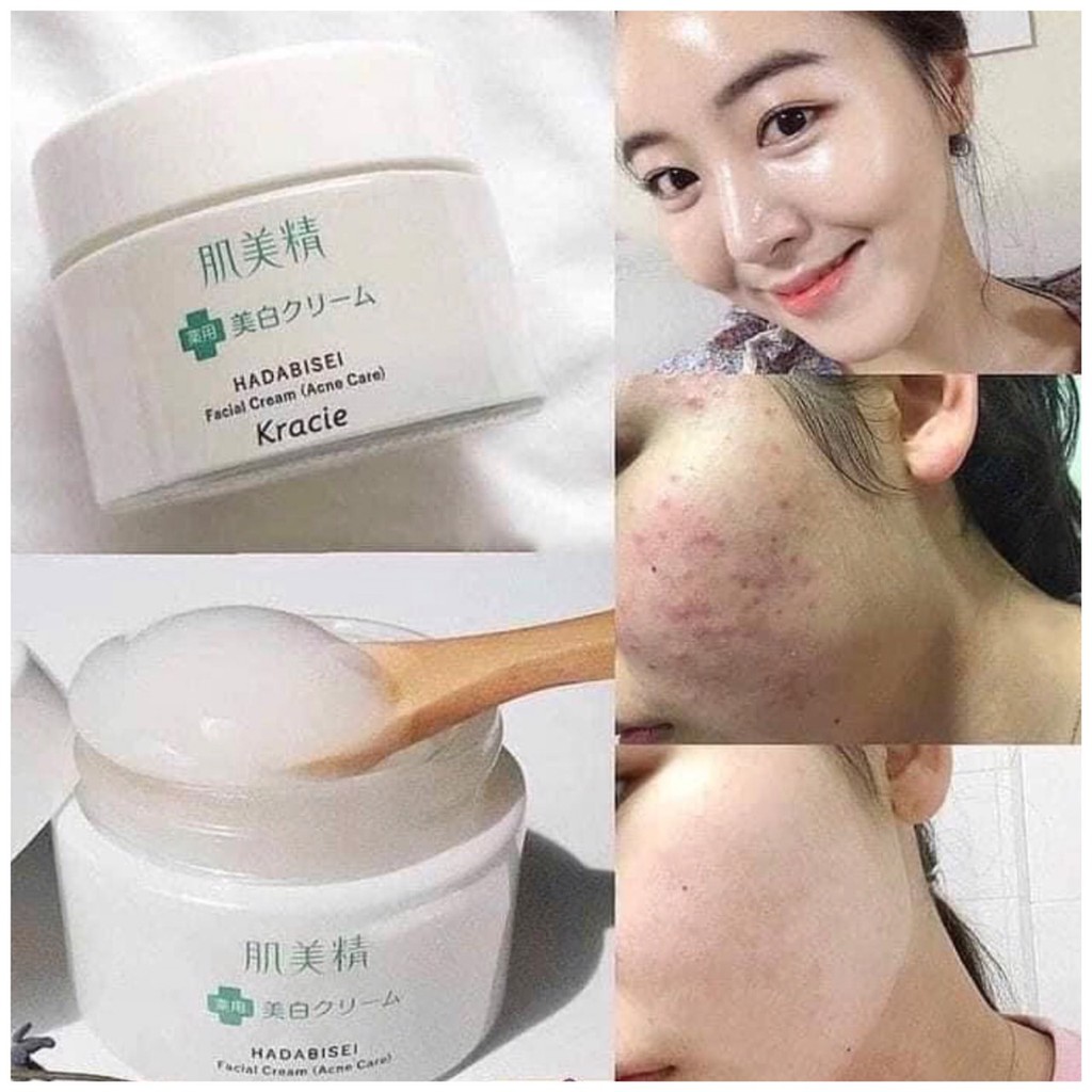 Kem DƯỠNG CHO DA DẦU MỤN Kracie Nhật Bản Hadabisei Facial Cream 50g