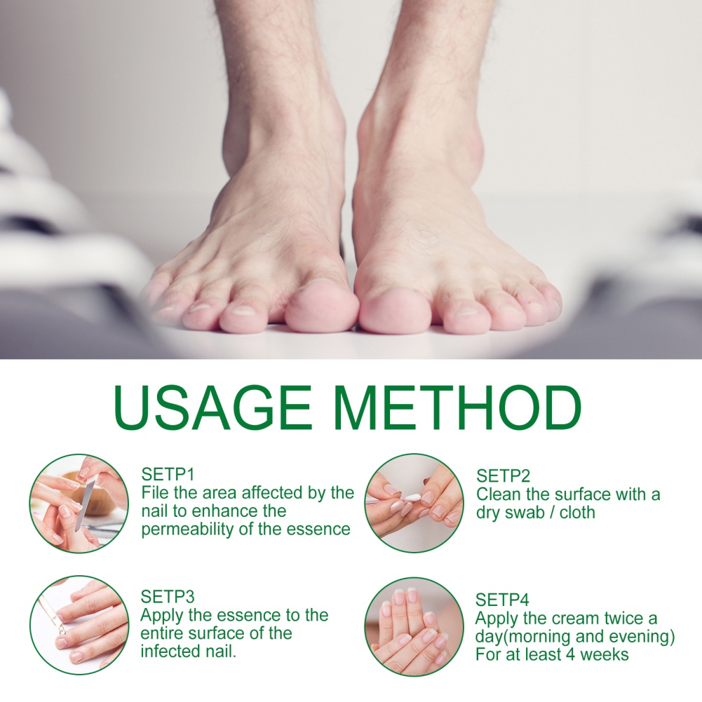 Jaysuing 30Ml Dung Dịch Chăm Sóc Móng Tay Gừng 30Ml Kem Dưỡng Ẩm Móng Tay Sáng Màu Mềm Chăm Sóc Móng Tay Chăm Sóc Móng Chân Có Hàng Thanh Toán Khi Nhận Hàng