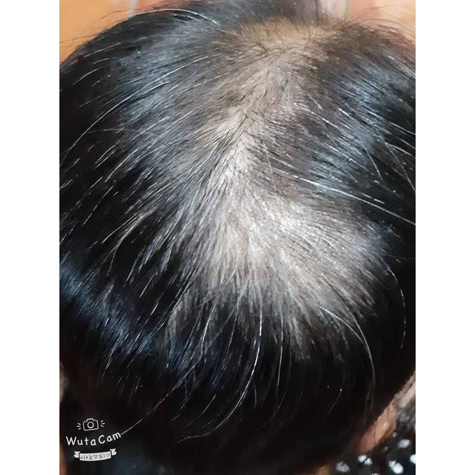 [ Tặng Cột Tóc + Date Mới ] Tinh Dầu Bưởi Vy Jully Giúp Gẫy Rụng Và Mọc Tóc Con 100ml | BigBuy360 - bigbuy360.vn