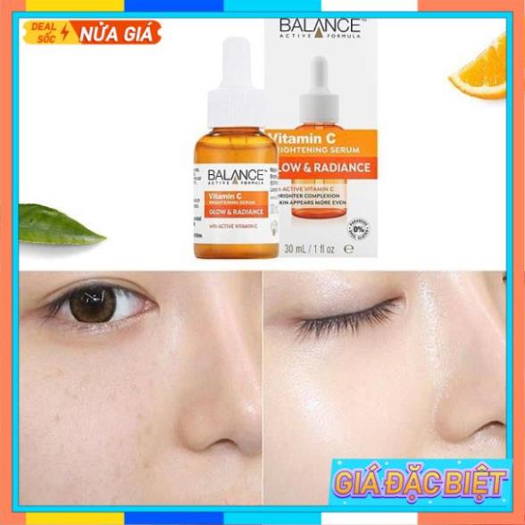 serum vitamin c balance , Trắng Da - Mờ Thâm 30ml | BigBuy360 - bigbuy360.vn