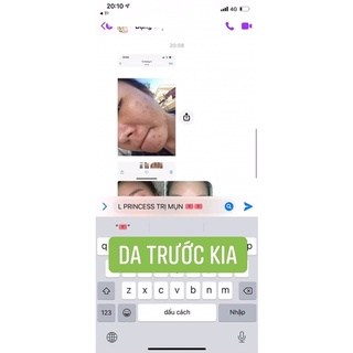 Comboo mụn