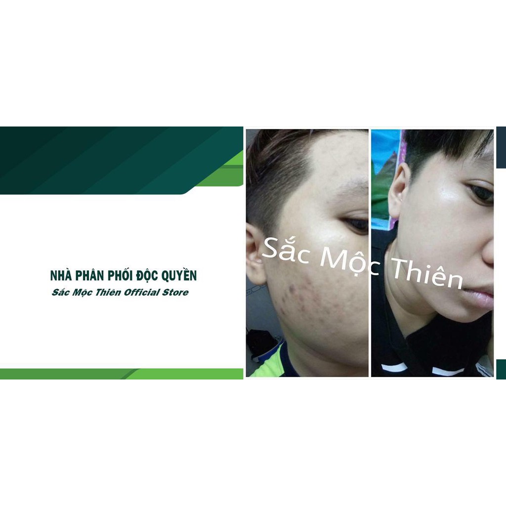 Sét 2 Chai Tinh Chất Dưỡng Da Sắc Mộc Thiên 10ml