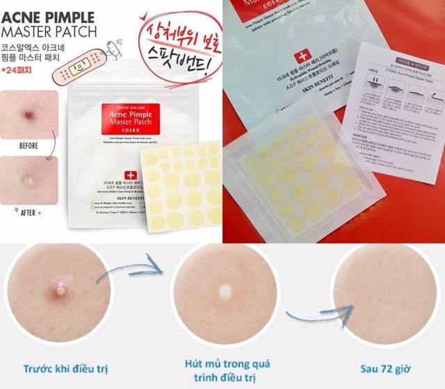 [Chính Hãng 100%] Miếng Dán Mụn Cosrx Acne Pimple Master Patch