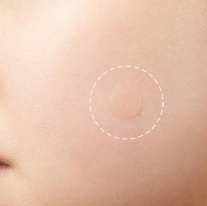 [Hàng mới về] Tờ 36 miếng dán loại bỏ mụn vô hình chăm sóc làn da tiện lợi